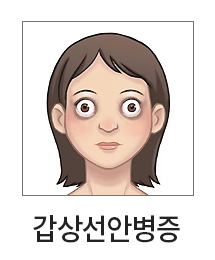 ���󼱾Ⱥ���