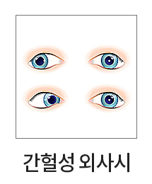 ���漺 �ܻ��