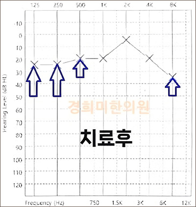 전후사진 이미지4