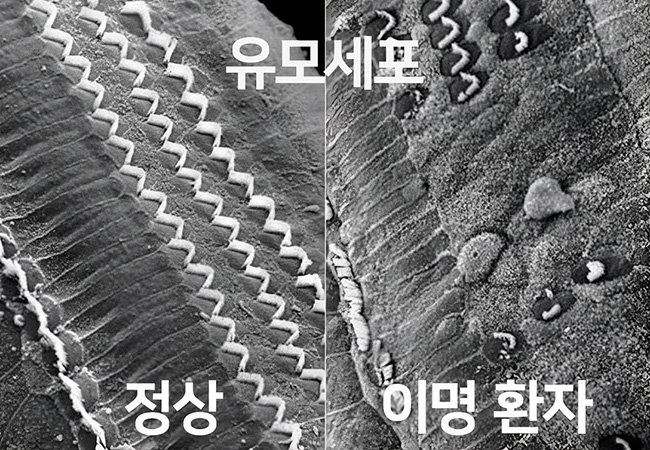 증상 이미지5