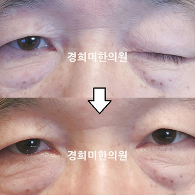 전후사진 이미지5