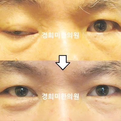 전후사진 이미지7