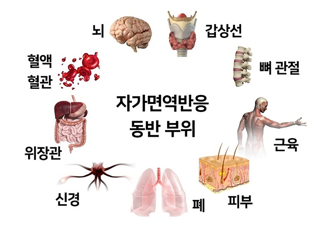 원인 이미지3