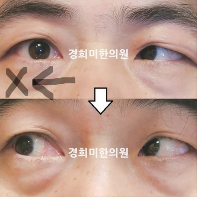 전후사진 이미지12