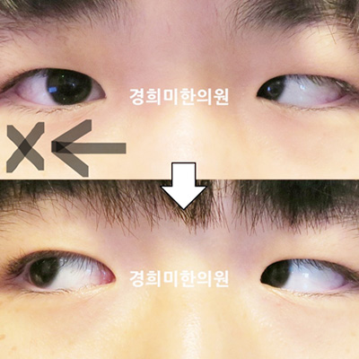 전후사진 이미지2