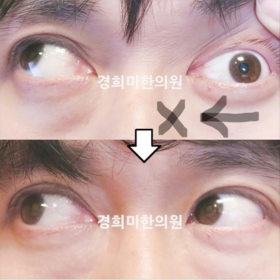 전후사진 이미지3