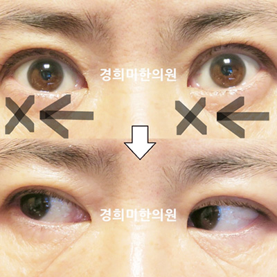 전후사진 이미지7
