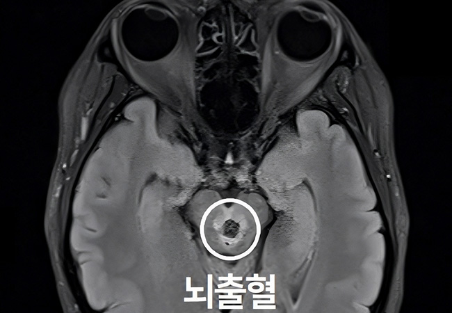 원인 이미지2