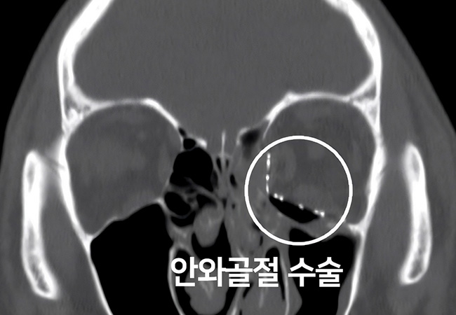 원인 이미지6