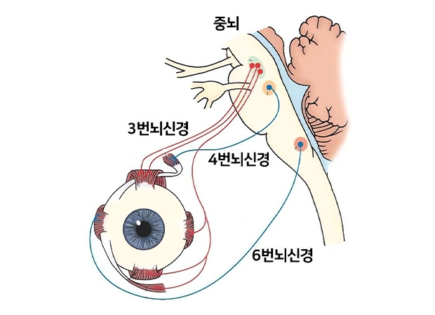증상 이미지1