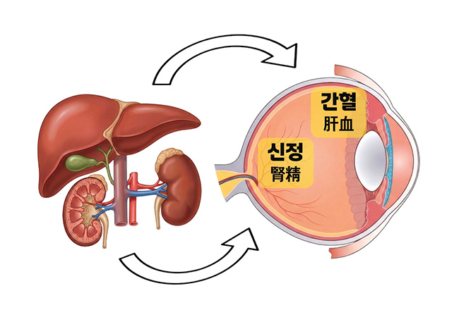 원인 이미지1