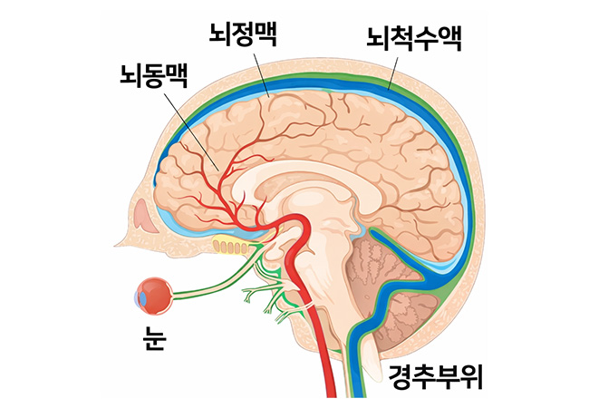 원인 이미지4