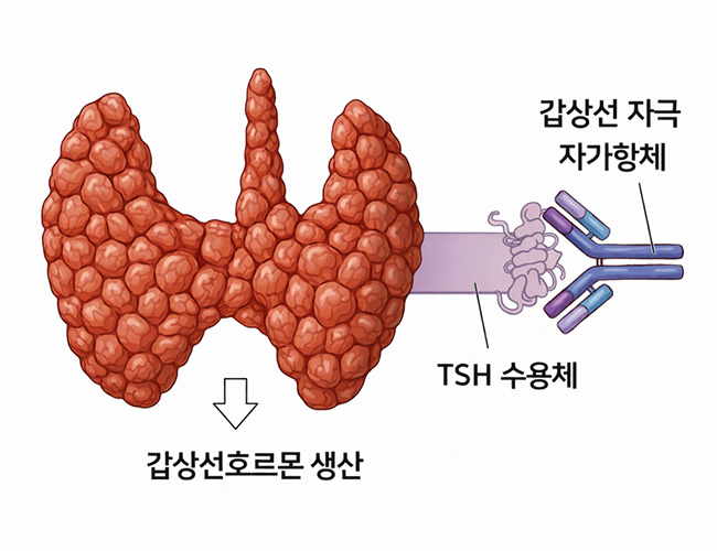 검사 이미지2