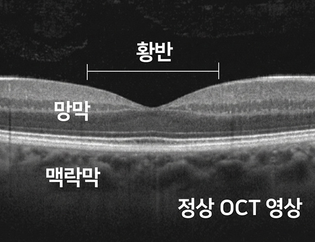 정의 이미지1