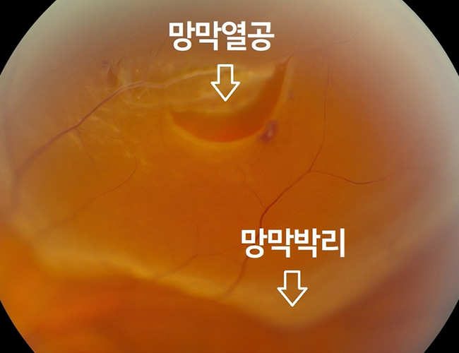 정의 이미지1