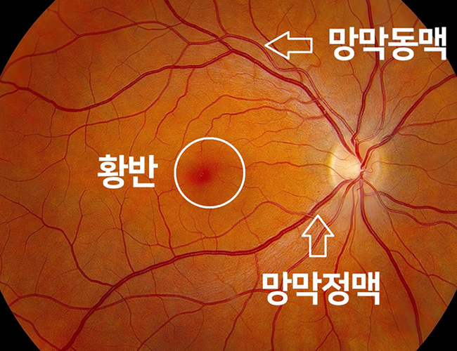 정의 이미지2