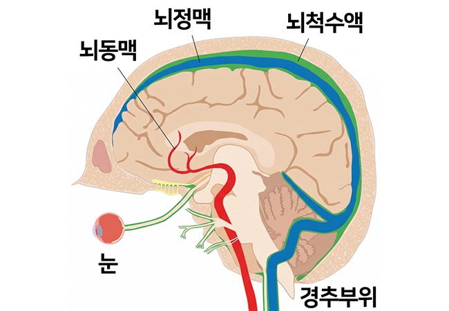 원인 이미지5