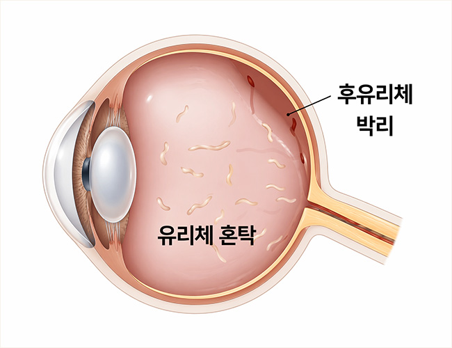 정의 이미지1
