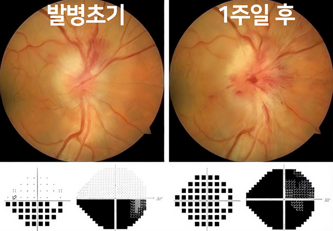 종류 이미지1