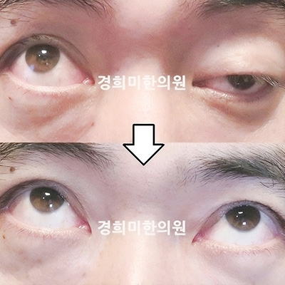 이미지02