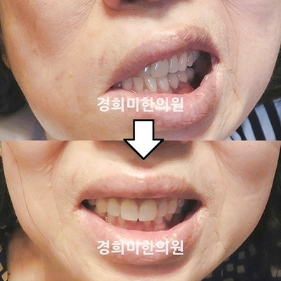 이미지06