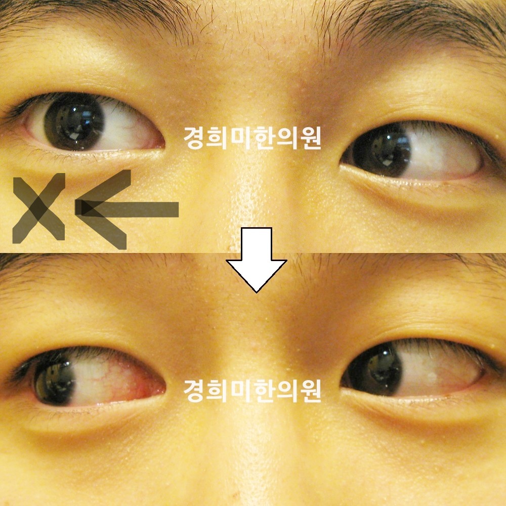 2번-10318-강강-표시.jpg