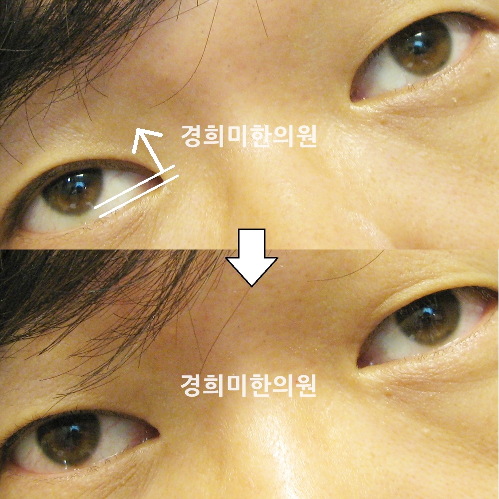 4번-11108-강약.jpg