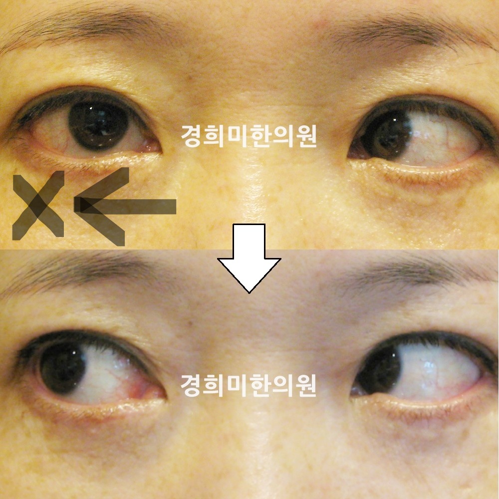 6번-11550-강중-표시.jpg