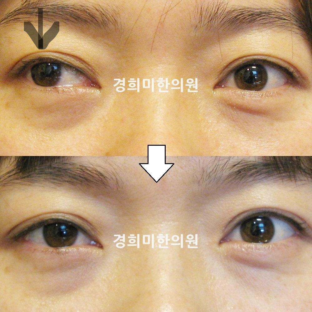 8번-11991-강약-표시.jpg