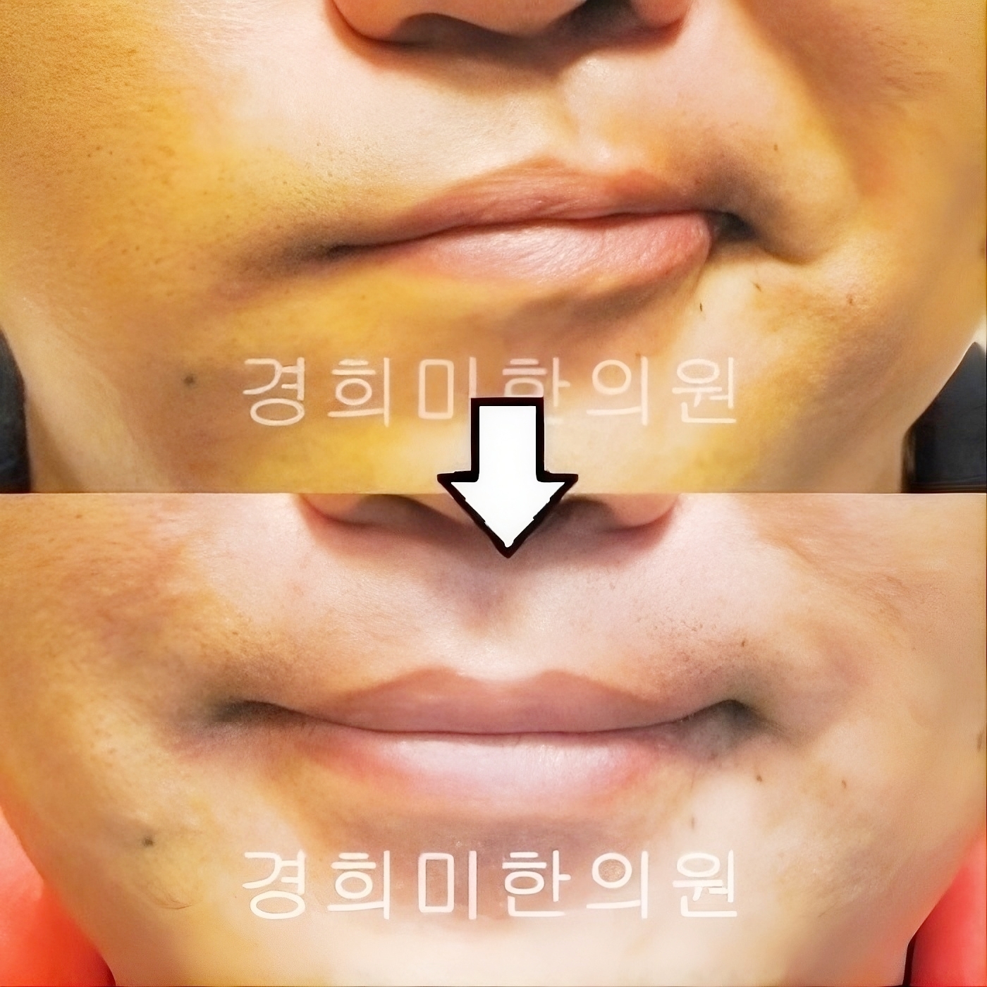 3번-11722.jpg