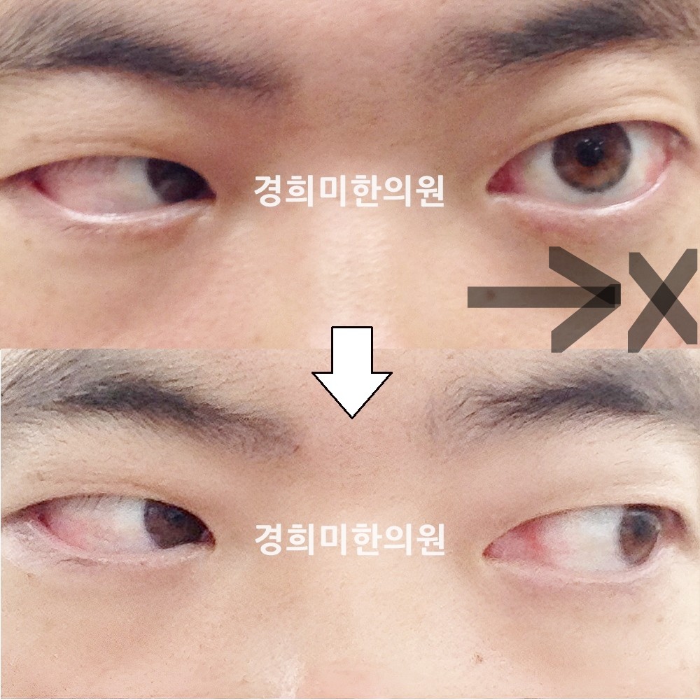 13번-12187-강중-표시.jpg