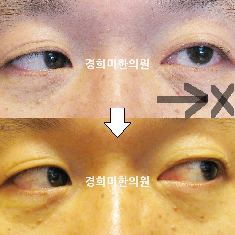 14번-12217-강중-표시.jpg