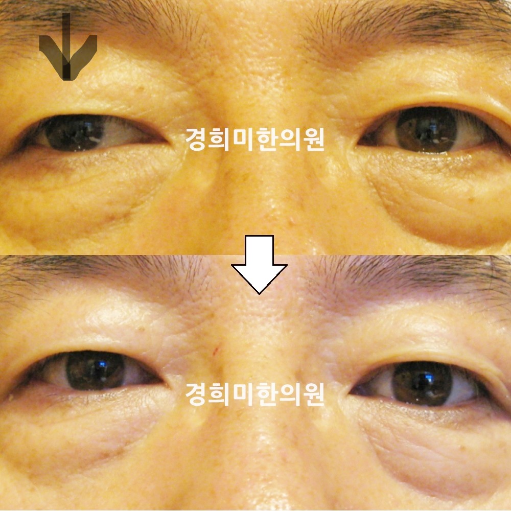 15번-12504-강강-표시.jpg
