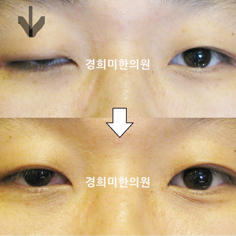 16번-12662-강중-표시.jpg