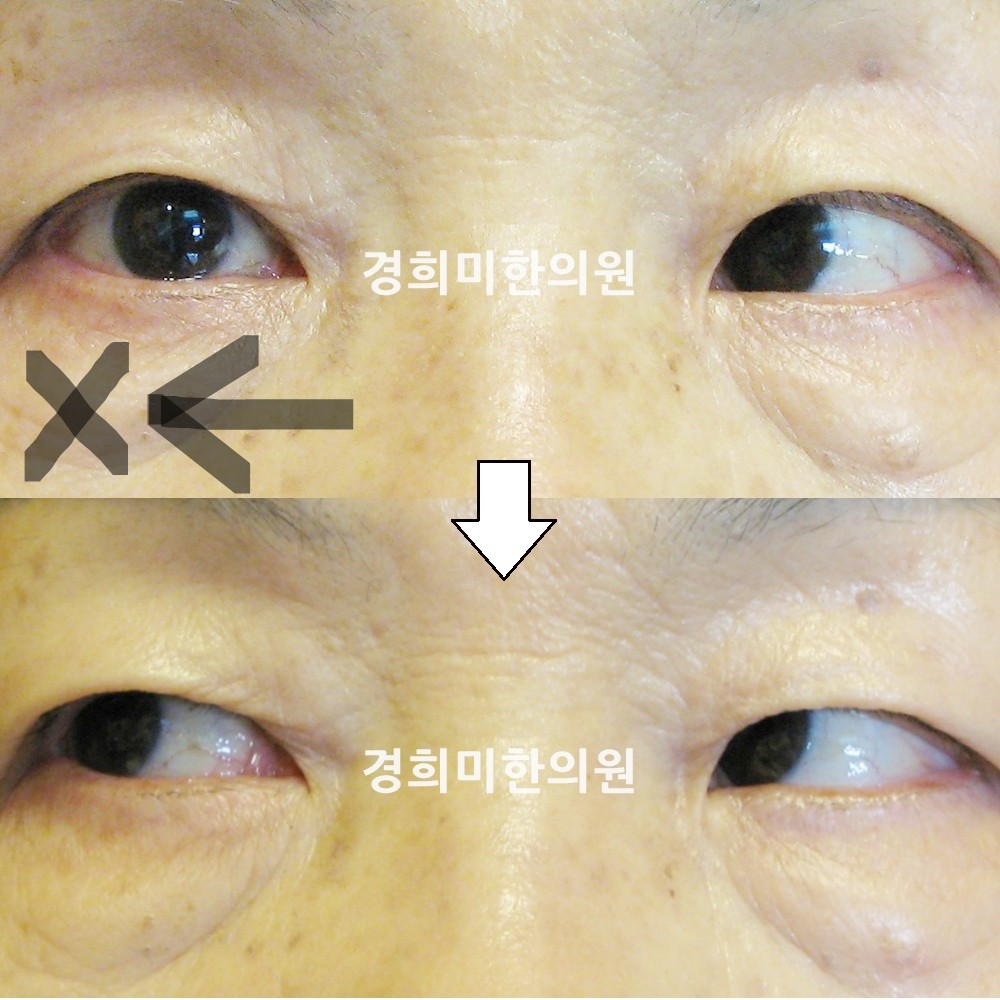17번-12685-강중-표시.jpg