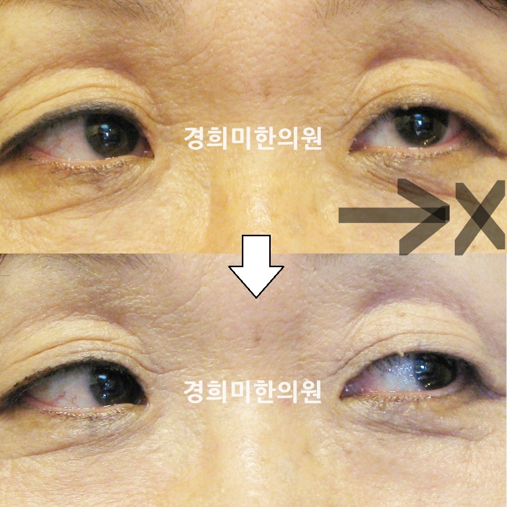 18번-12782-강중-표시.jpg