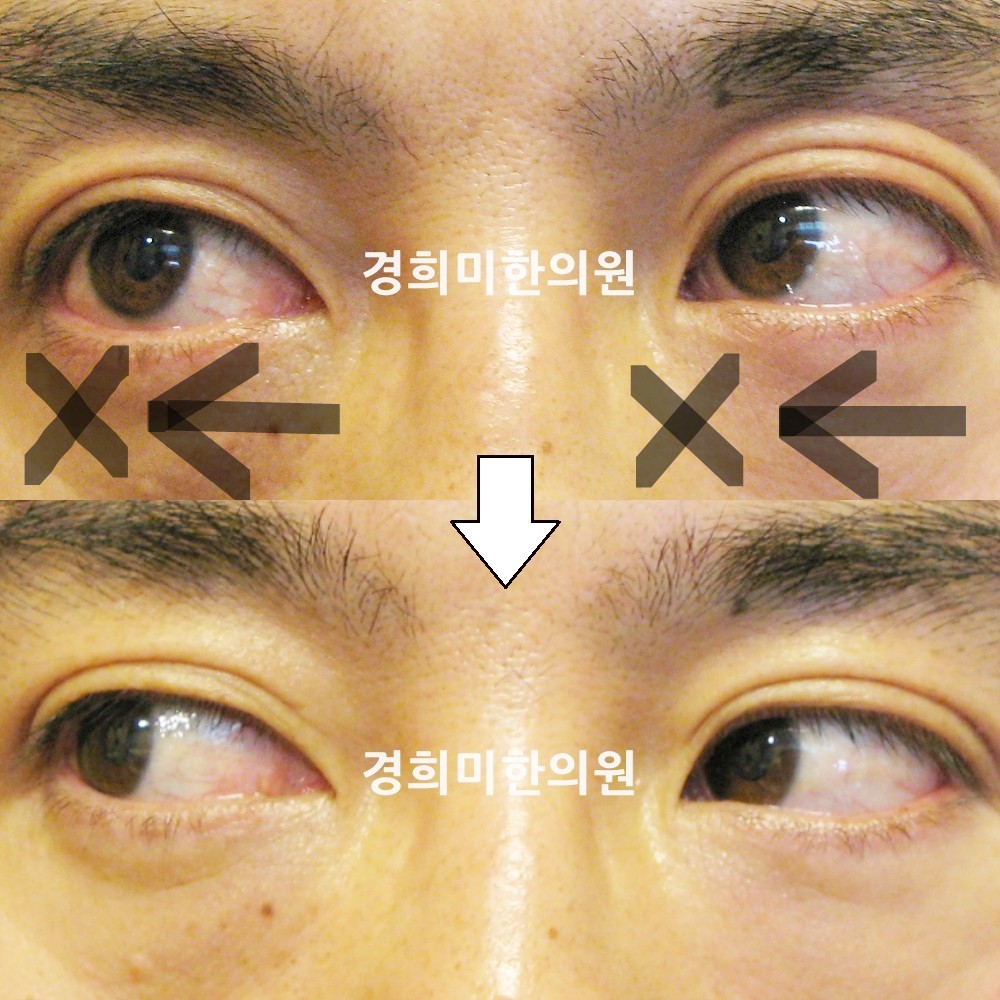 20번-12813-1-강강-표시.jpg
