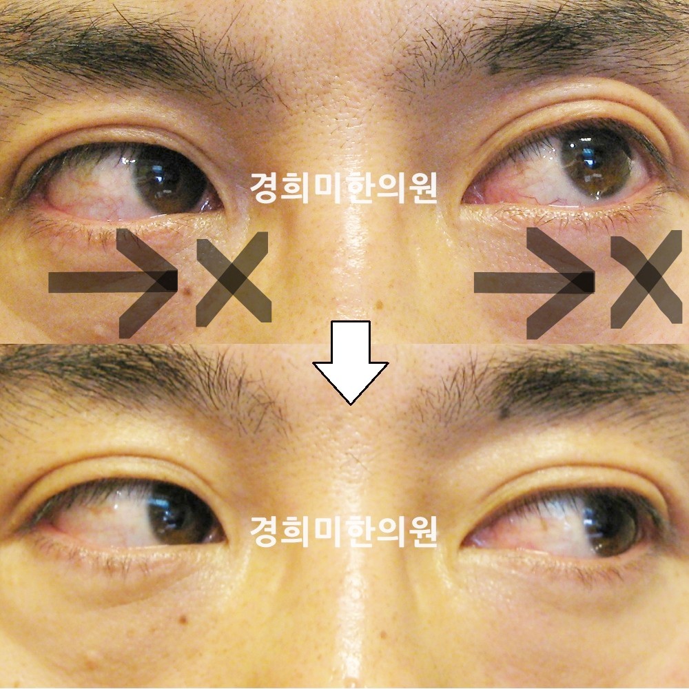 20번-12813-2-강강-표시.jpg