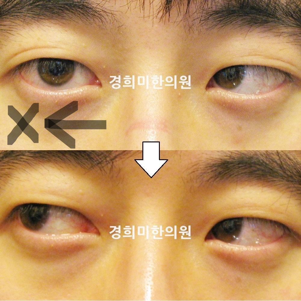 22번-12749-강중-표시.jpg