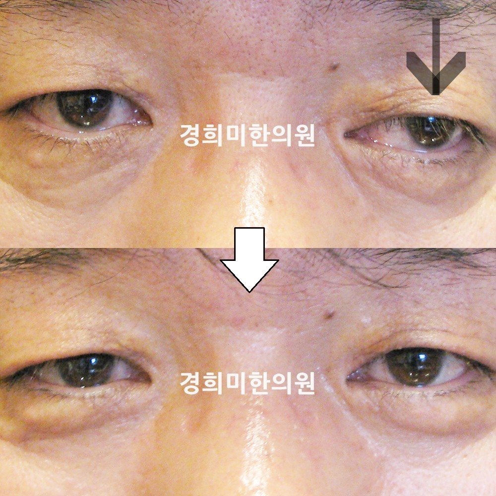 23번-12817-강강-표시.jpg