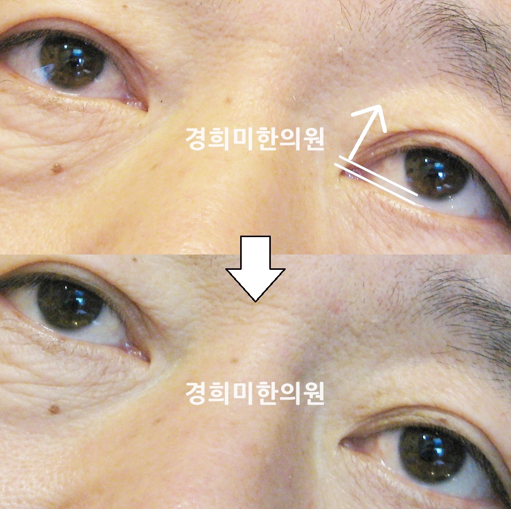24번-12930-강강.jpg