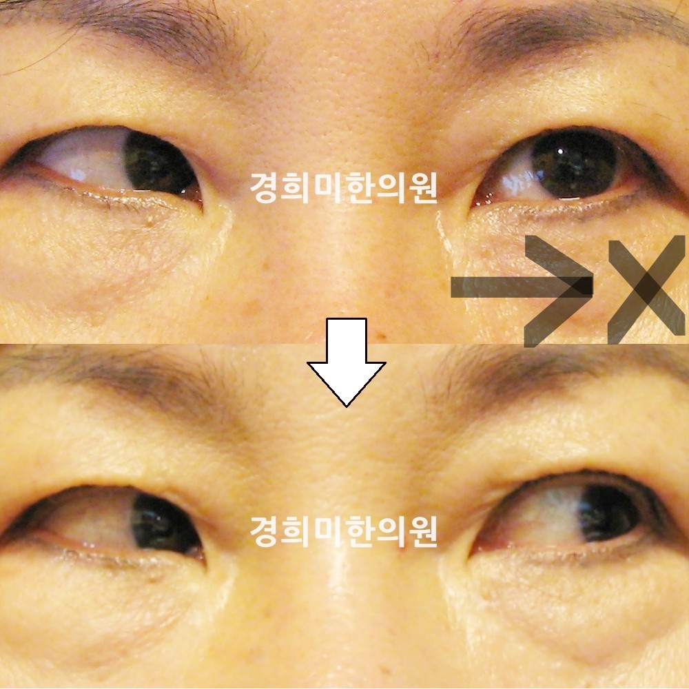 30번-13411-강중-표시.jpg