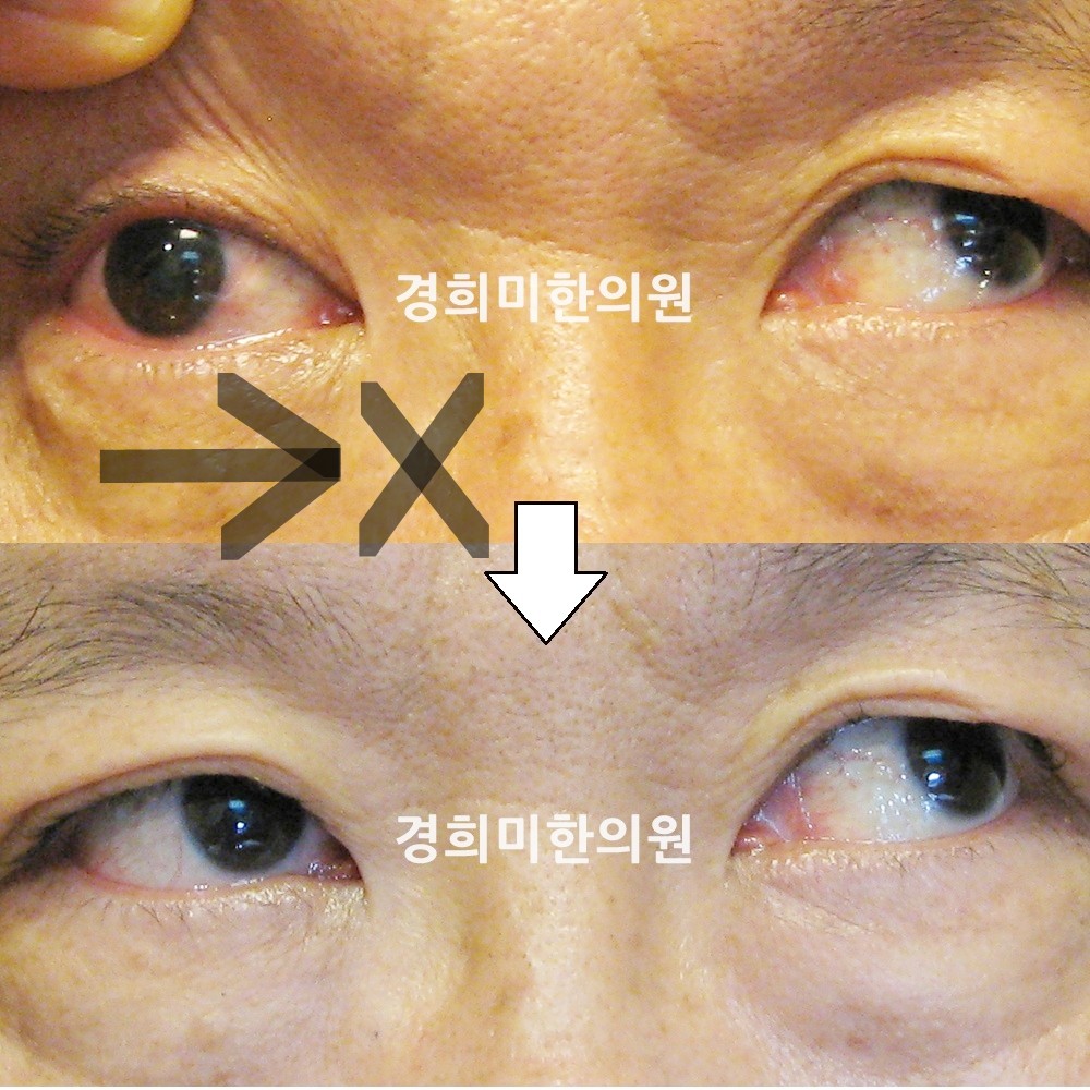 31번-13524-2-강강-표시.jpg