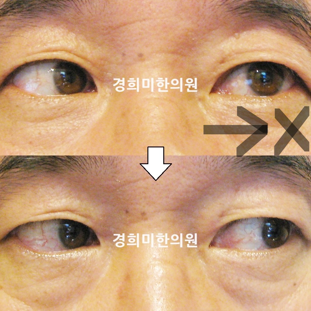 32번-13500-강강-표시.jpg