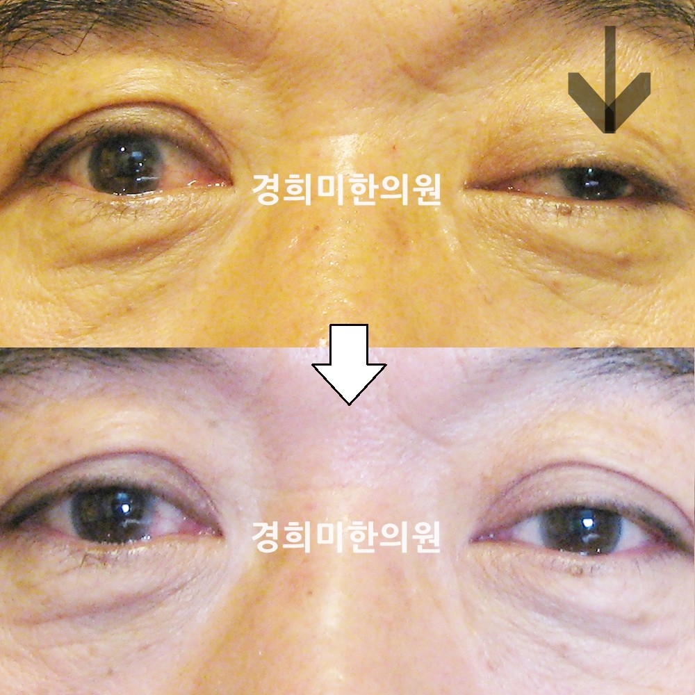 35번-13497-1-강강-표시.jpg