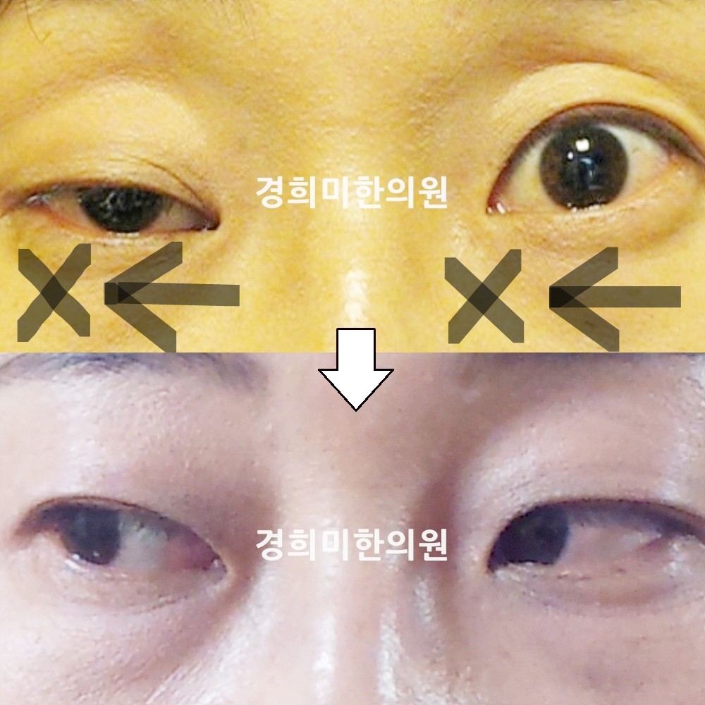 37번-13728-1-강강-표시.jpg