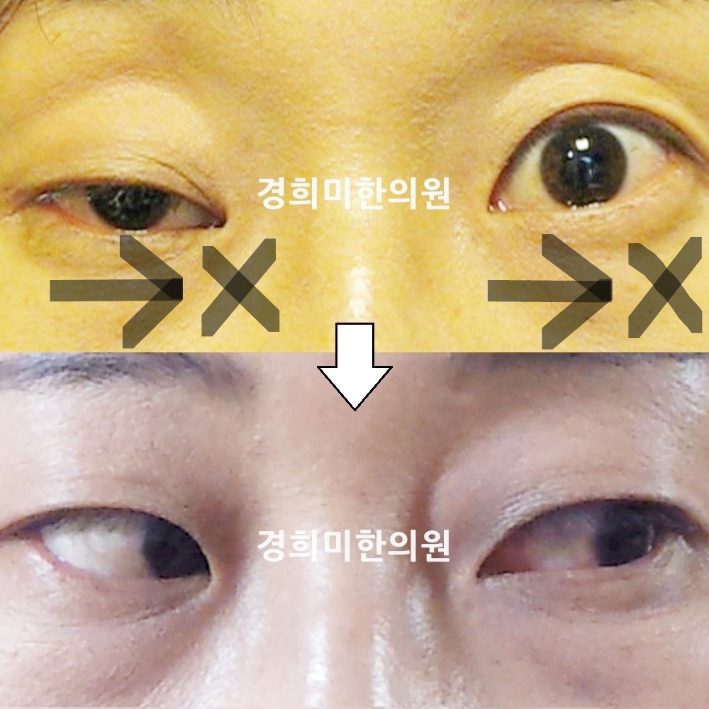 37번-13728-2-강강-표시.jpg