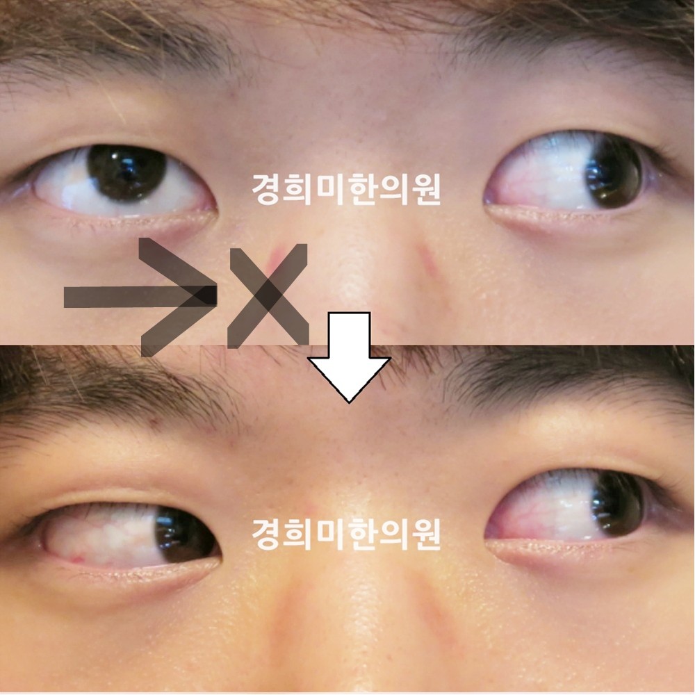 41번-12872-2-강강-표시.jpg