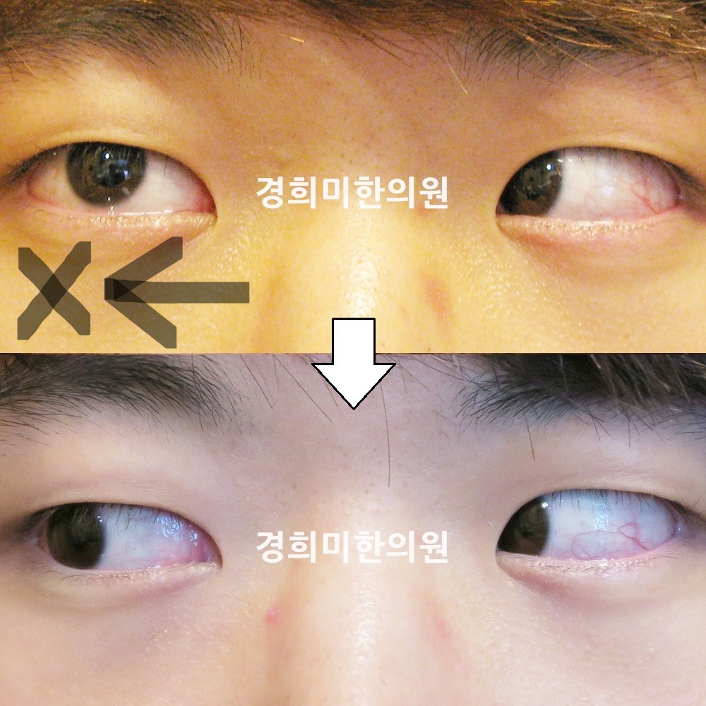 41번-12872-1-강강-표시.jpg