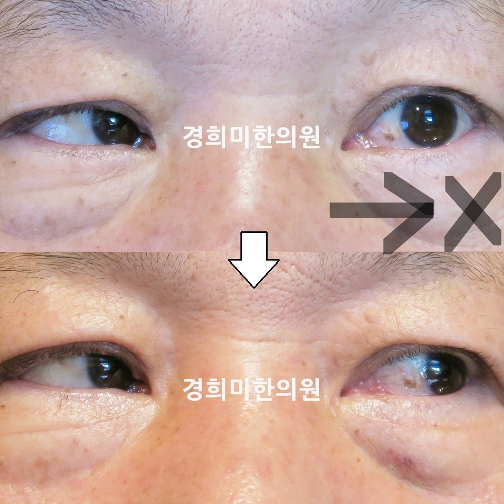 43번-13961-강강-표시.jpg